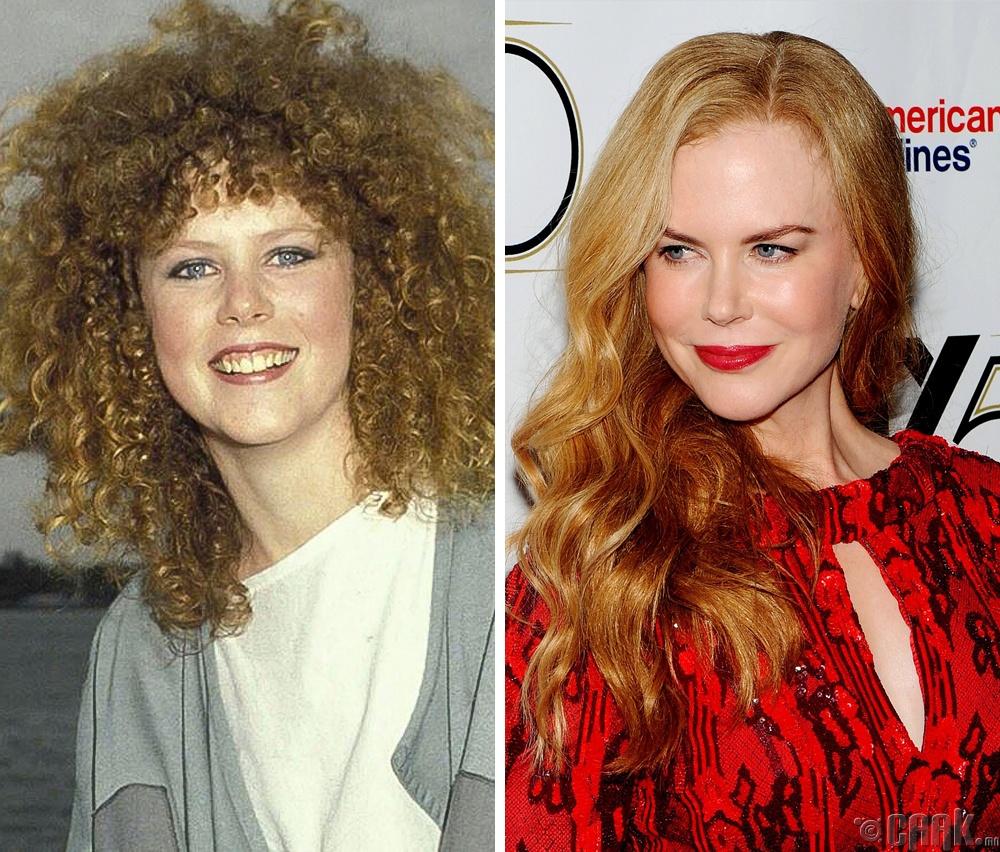 Николь Кидмэн (Nicole Kidman), 1983 он