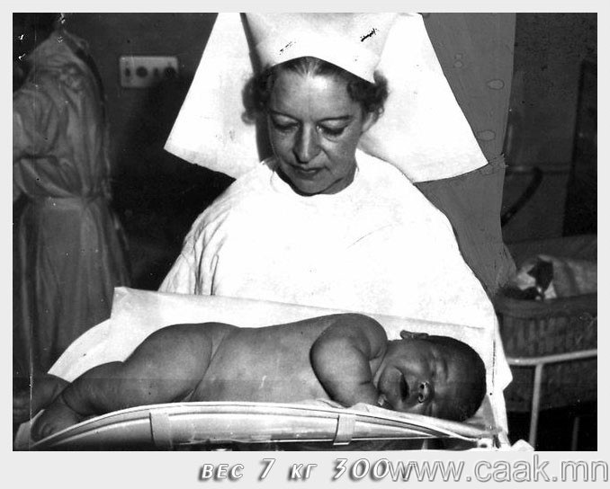 Жон Сочаки, 7.3 кг жинтэй хүүхэд. 1963 он