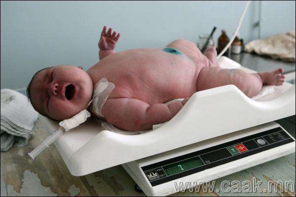 Алтай, 7.7 кг жинтэй хүүхэд