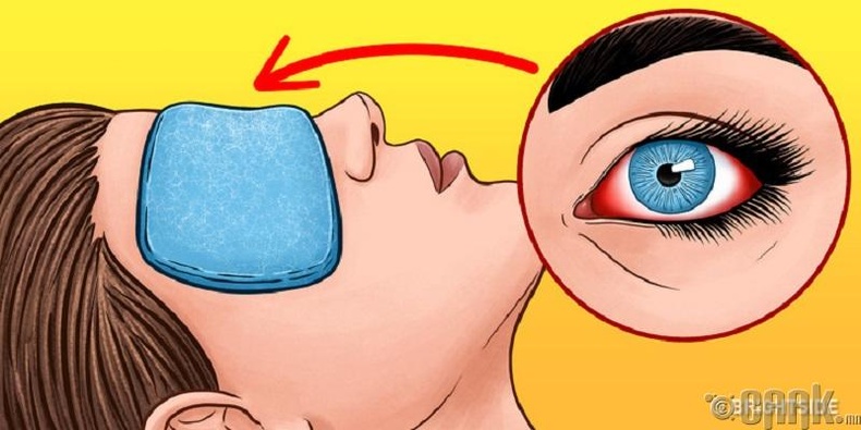 Нүд улайлтыг хэрхэн бууруулах вэ?