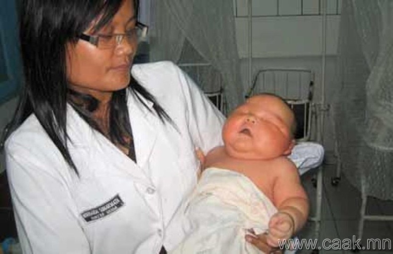 Индонези, 9 кг жинтэй хүүхэд