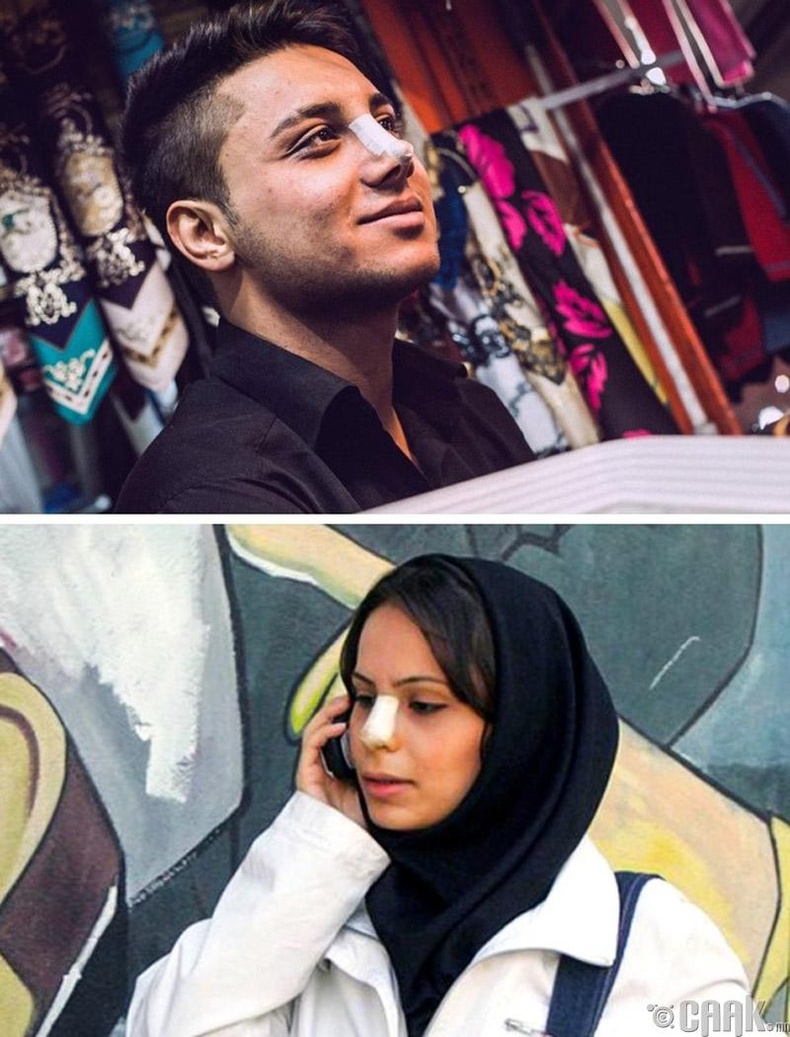 Иран - Нүүрний хагалгаа