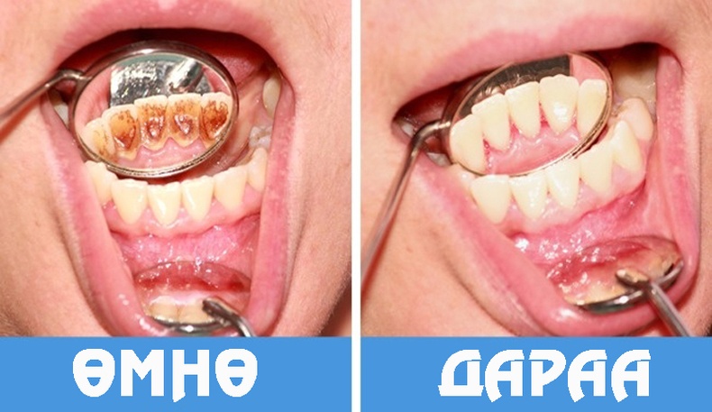 Бидний шүдээ арчлахдаа гаргадаг 8 алдаа