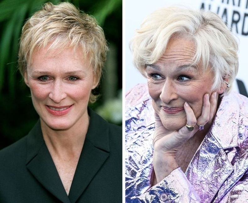 Гленн Клоуз (Glenn Close)