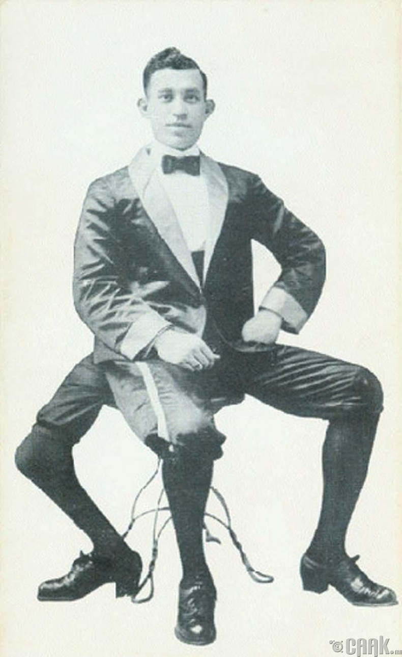 Видит три ноги. Франческо Лентини. Франческо (Фрэнк) Лентини. Франческо Лентини человек с тремя ногами.1889. Фрэнк Лентини человек с тремя.
