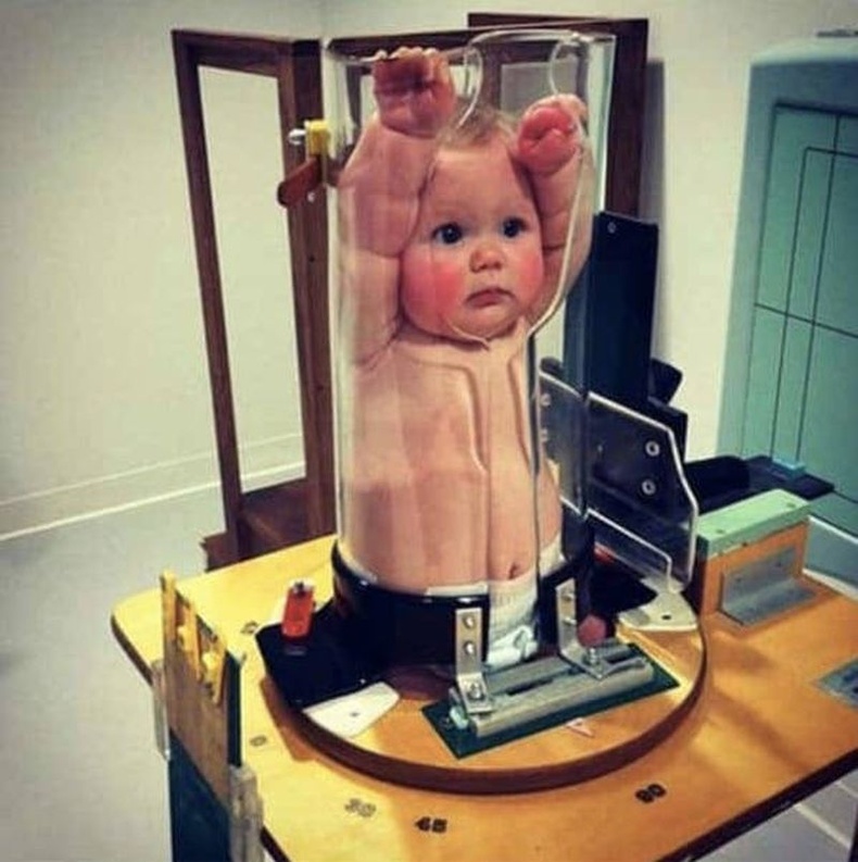 Нялх хүүхдийн рентген зургийг ингэж дардаг