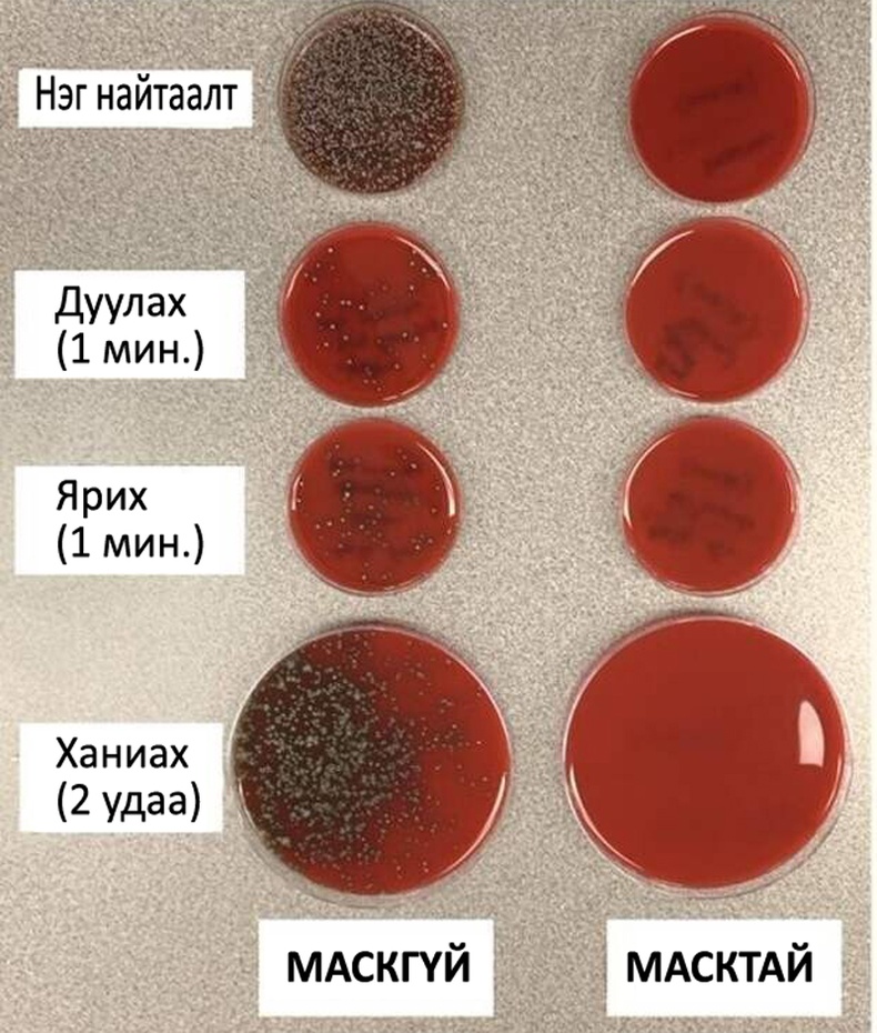 Вирус тархах ялгаа (Маскгүй, масктай)