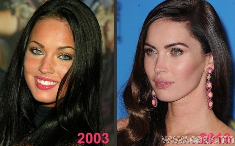 Меган Фокс (Megan Fox), гоо сайхны мэс засалд орсон