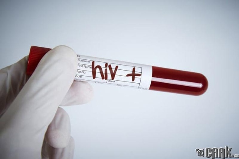 Грек улсад ХДХВ-гийн халдвартай хүмүүс зайлшгүй шинжилгээ өгөх ёстой