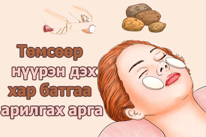 Хар батгыг гэрийн нөхцөлд арилгах аргууд