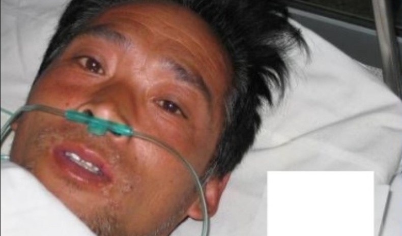 "Цацраг идэвхт эр" - Амьдын тамыг биеэрээ мэдэрсэн Хисаши Оүчигийн түүх