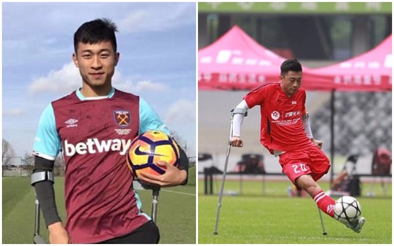Нэг хөлгүй Хятад залуу, хөлбөмбөгийн ертөнцийг гайхшруулж байна