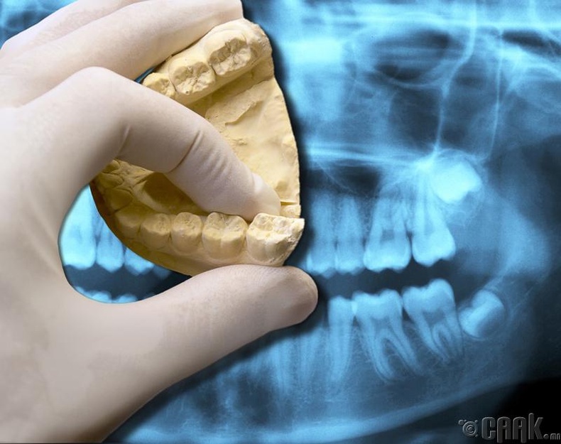 Шүдний гажиг заслын сайн эмч хаанаас олох вэ?