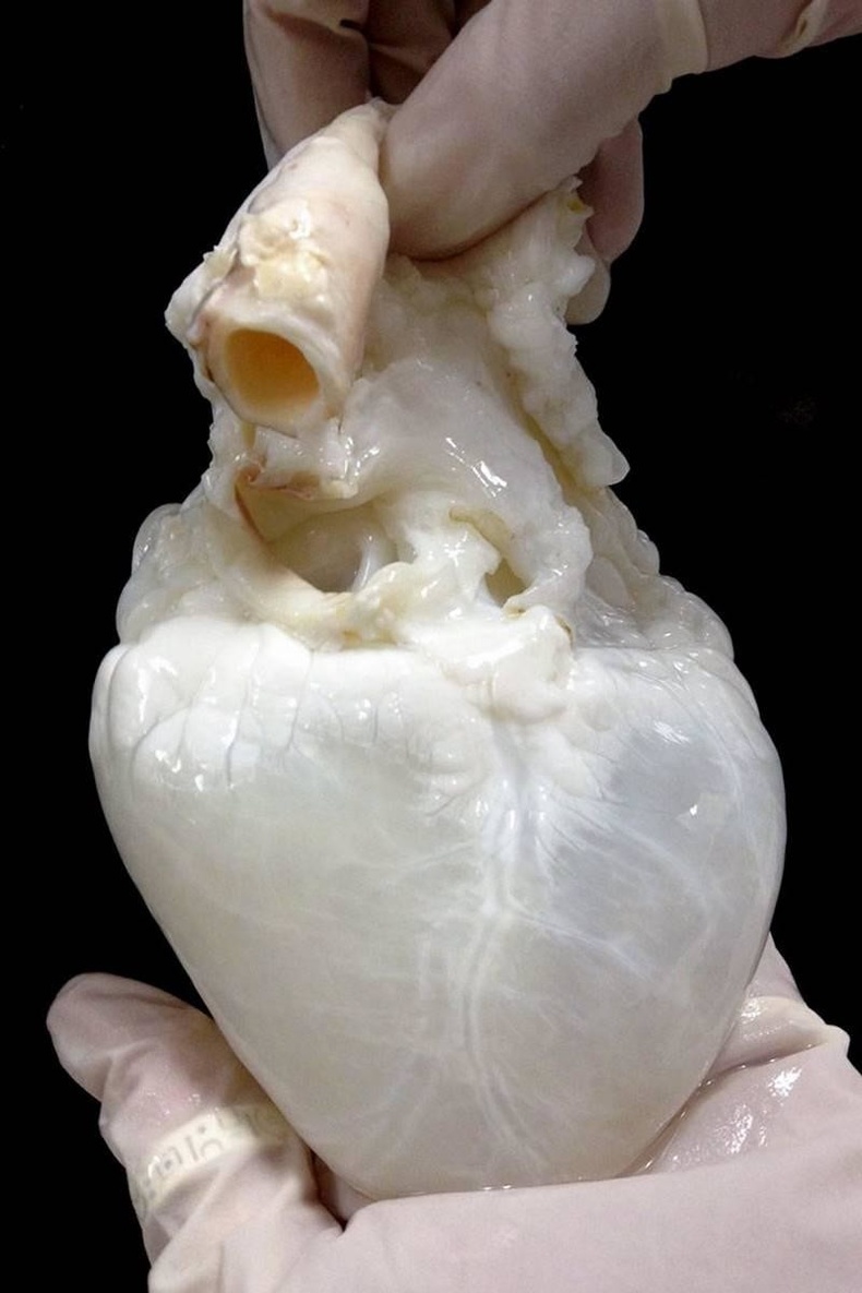 Эрдэмтдийн үзэж байгаагаар "үхсэн зүрх"-ийг хүний үүдэл эсээр хангаж чадвал энэ нь донорын зүрхийг ургуулахад туслах юм