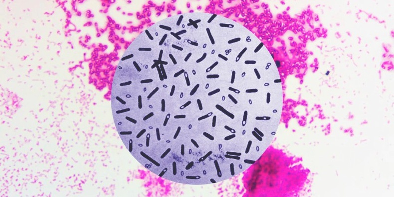 Ботулизм (Clostridium botulinum)