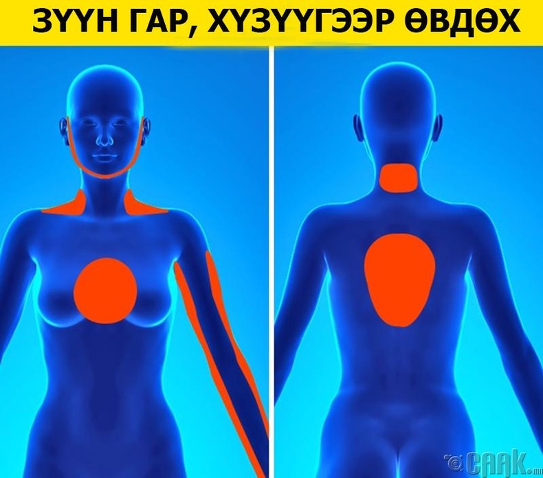 Зүрхний шигдээсийг хэрхэн мэдэх вэ?