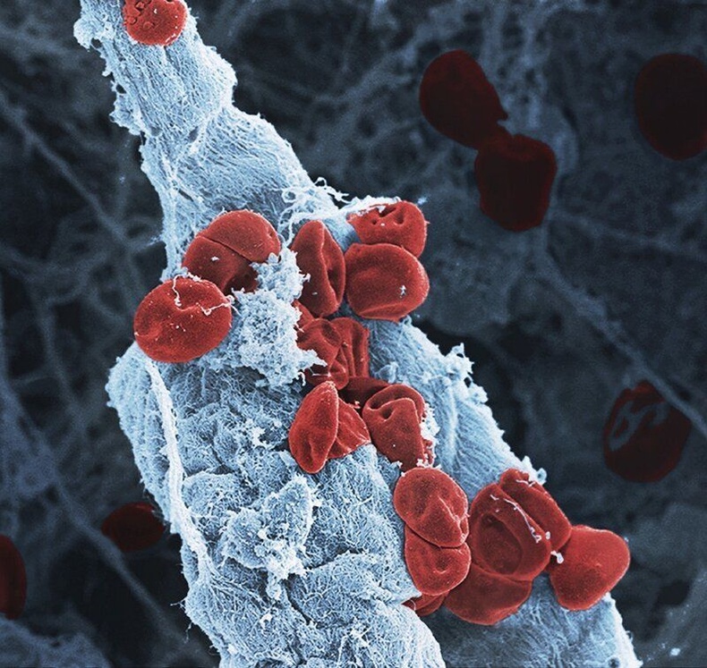 Гэмтсэн судас дээрх цусны улаан эсүүд