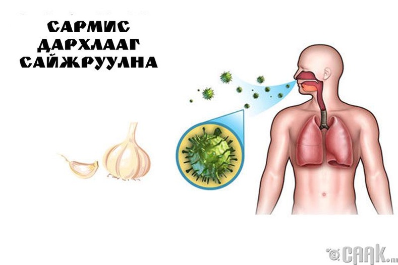 Сармис дархлааг дэмжинэ