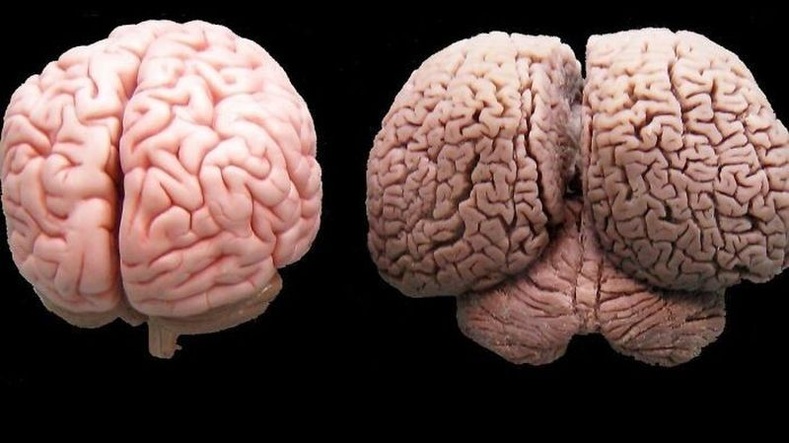 Хүний тархи ба дельфиний тархи