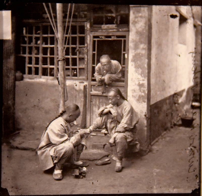 Эмчид хөлөө үзүүлж буй эр - Бээжин. 1869 он