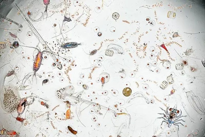 Далайгаас авсан дусал усыг микроскопоор харвал...