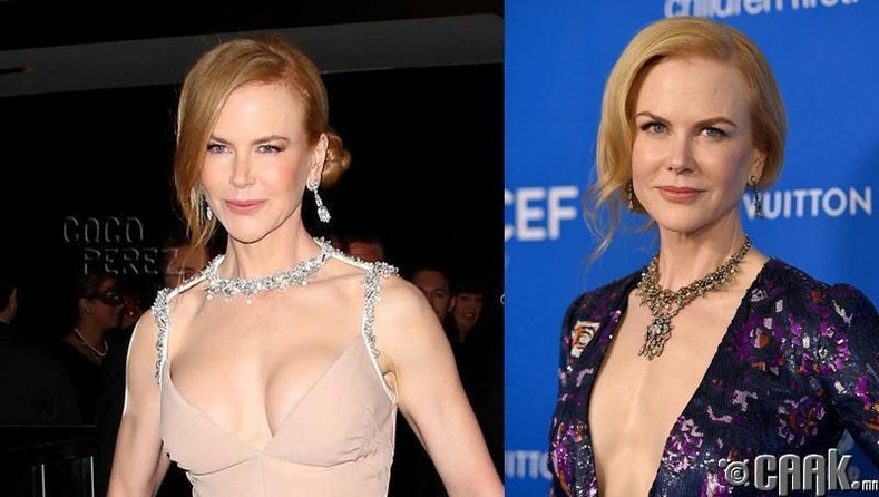 Николь Кидман (Nicole Kidman)