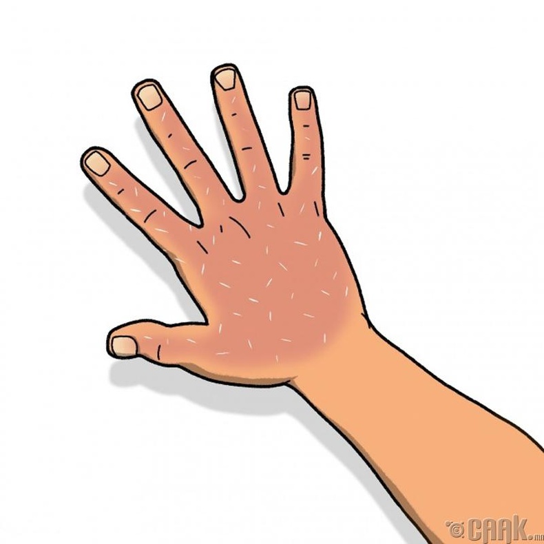 Гараа хөлдөөсөн эсэхээ хэрхэн мэдэх вэ?
