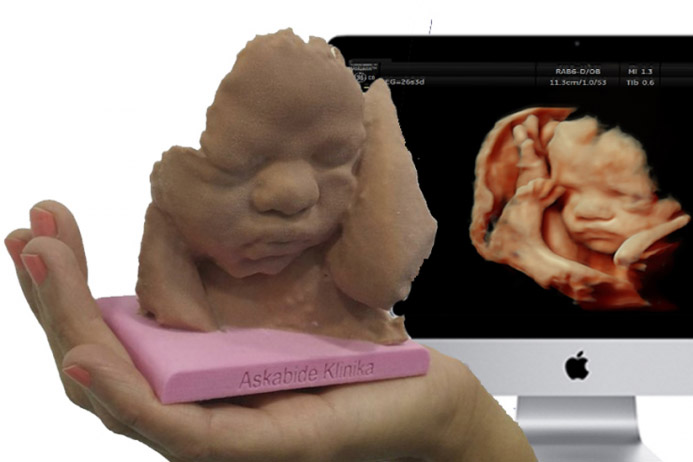 3D-принтерээр эхийн хэвлийд буй хүүхдийн барималыг хийдэг болжээ 